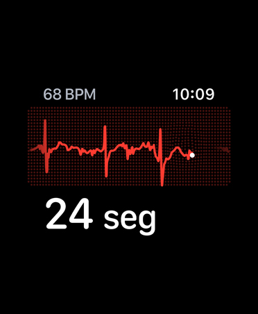 App ECG, batimentos por minuto no canto superior direito, linha de ritmo, timer
