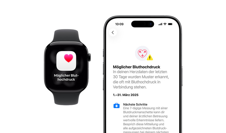 Mitteilung: Möglicher Bluthochdruck auf der Apple Watch Series 11, ausführlichere Mitteilung auf dem iPhone