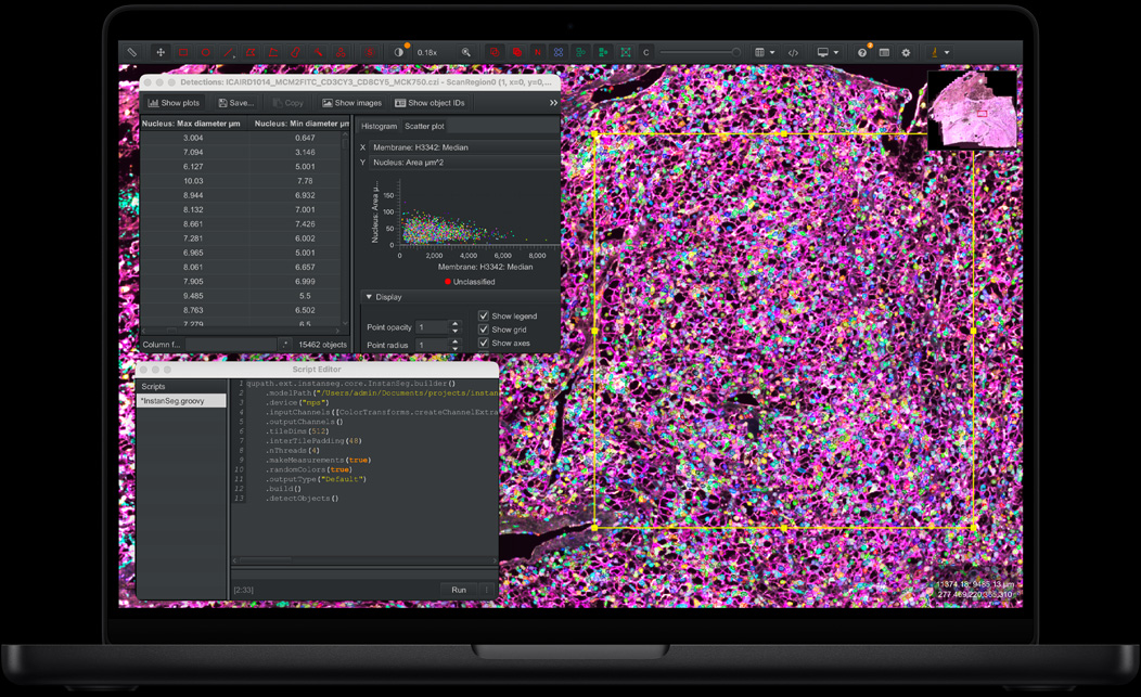 MacBook Pro Display mit QuPath und Instanseg